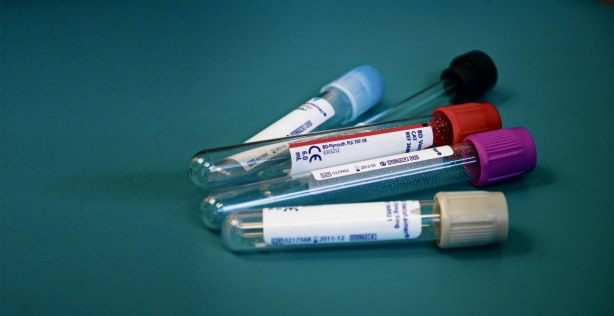 13 analize de care nu trebuie să fugi!